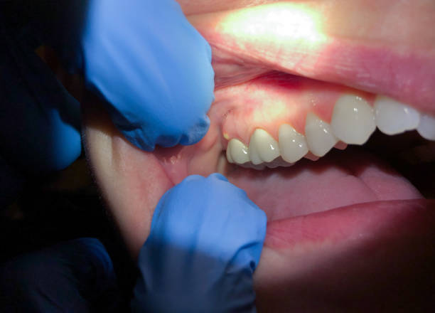 Best Emergency Tooth Extraction  in East Bethel, MN